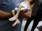 Hunger is Stealing Gaza’s Children A Human Tragedy That Could Be Stopped