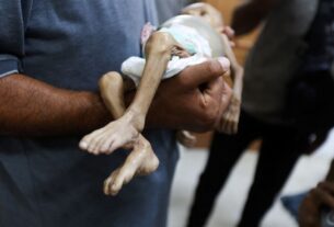 Hunger is Stealing Gaza’s Children A Human Tragedy That Could Be Stopped